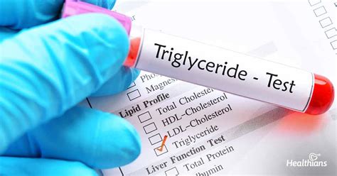 why do you check triglycerides